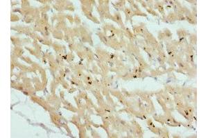 Immunohistochemistry of paraffin-embedded human heart tissue using ABIN7149013 at dilution of 1:100 (CSRP3 Antikörper  (AA 1-194))
