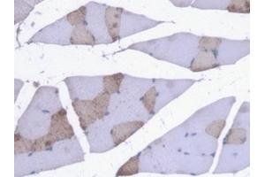 IHC-P analysis of Mouse Skeletal muscle Tissue, with DAB staining. (Myoglobin Antikörper  (AA 1-154))