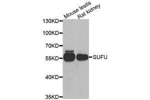 Western blot analysis of extracts of various cell lines, using SUFU antibody. (SUFUH Antikörper  (AA 325-484))
