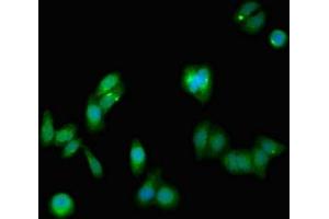 Immunofluorescent analysis of HepG2 cells using ABIN7161294 at dilution of 1:100 and Alexa Fluor 488-congugated AffiniPure Goat Anti-Rabbit IgG(H+L) (Notch1 Antikörper  (AA 2428-2555))