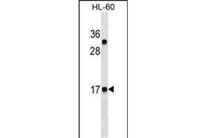 CALCA/CT Antibody ABIN1536608 western blot analysis in HL-60 cell line lysates (35 μg/lane). (Calcitonin Antikörper  (AA 104-132))