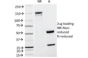 SDS-PAGE Analysis Purified TYRP1 Mouse Monoclonal Antibody (TA99). (Tyrosinase-Related Protein 1 Antikörper)