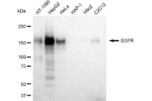 Western blotting analysis using EGFR antibody (ABIN7798462).