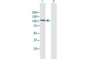 Western Blot analysis of PRPF6 expression in transfected 293T cell line by PRPF6 MaxPab polyclonal antibody. (PRP6/ANT-1 Antikörper  (AA 1-941))