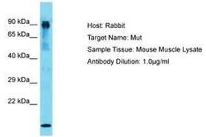 Image no. 1 for anti-Methylmalonyl Coenzyme A Mutase (MUT) (AA 44-93) antibody (ABIN6750352) (MUT Antikörper  (AA 44-93))