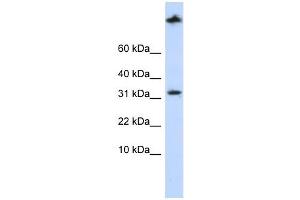 SCP2 antibody used at 1 ug/ml to detect target protein. (SCP2 Antikörper  (Middle Region))