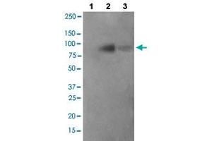 Western blot analysis of Lane 1: antigen-specific peptide treated JK cells, Lane 2: JK cells cells, Lane 3: COS-7 cells with FER (phospho Y402) polyclonal antibody  at 1:500-1:1000 dilution. (FER Antikörper  (pTyr402))