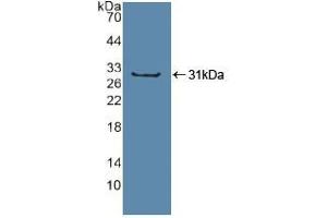 Western blot analysis of recombinant Human Sp100. (SP100 Antikörper  (AA 610-802))