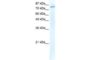 WB Suggested Anti-GTF3C3 Antibody Titration:  1. (GTF3C3 Antikörper  (N-Term))