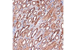 Immunohistochemistry of paraffin-embedded rat kidney using Carbonic Anhydrase 2 (C) Rabbit mAb (ABIN7266070) at dilution of 1:100 (40x lens). (CA2 Antikörper)