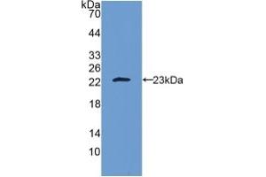 Western blot analysis of recombinant Human IL10. (IL-10 Antikörper  (AA 19-178))