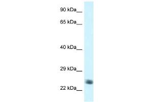 Western Blotting (WB) image for anti-NADH Dehydrogenase (Ubiquinone) Fe-S Protein 8, 23kDa (NADH-Coenzyme Q Reductase) (NDUFS8) (C-Term) antibody (ABIN926800)