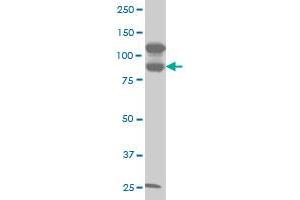 KSR2 monoclonal antibody (M06), clone 5E9 Western Blot analysis of KSR2 expression in A-431 . (KSR2 Antikörper  (AA 411-500))