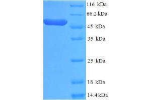SDS-PAGE (SDS) image for Casein Kinase 1, epsilon (CSNK1E) (AA 1-416), (full length) protein (His tag) (ABIN5709343) (CK1 epsilon Protein (AA 1-416, full length) (His tag))