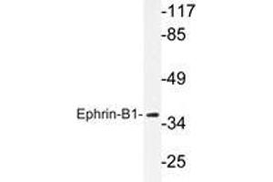 Western blot analysis of Ephrin-B1 antibody in extracts from COS7 cells. (Ephrin B1 Antikörper)