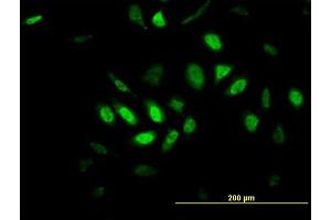 Immunofluorescence of monoclonal antibody to GPR135 on MCF-7 cell. (GPR135 Antikörper  (AA 391-493))