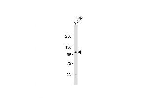 Western Blot at 1:1000 dilution + Jurkat whole cell lysate Lysates/proteins at 20 ug per lane. (Unc5c Antikörper  (N-Term))