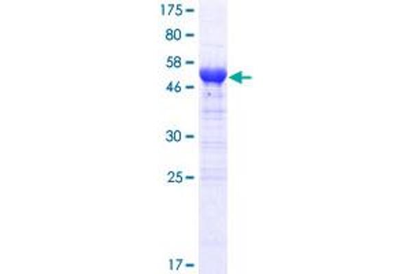 ARID3B Protein (AA 1-253) (GST tag)