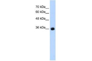 WB Suggested Anti-GABRG2 Antibody Titration:  1. (GABRG2 Antikörper  (C-Term))