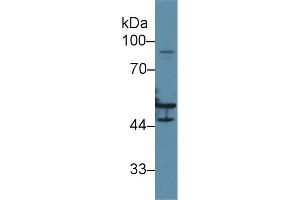 Western blot analysis of Human HeLa cell lysate, using Human KRT16 Antibody (2 µg/ml) and HRP-conjugated Goat Anti-Rabbit antibody ( (KRT16 Antikörper  (AA 117-419))