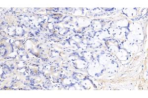 Immunohistochemistry (IHC) image for anti-Elastin (ELN) (AA 392-645) antibody (ABIN7433489)