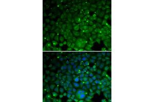 Immunofluorescence analysis of HeLa cell using CRYAA antibody. (CRYAA Antikörper)