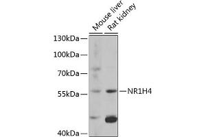 Western blot analysis of extracts of various cell lines, using NR1H4 antibody (ABIN6127919, ABIN6144801, ABIN6144803 and ABIN6216539) at 1:1000 dilution. (NR1H4 Antikörper  (AA 207-476))