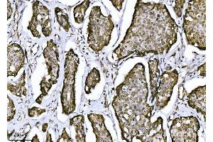 IHC analysis of NDFIP2 using anti-NDFIP2 antibody (ABIN7600173).