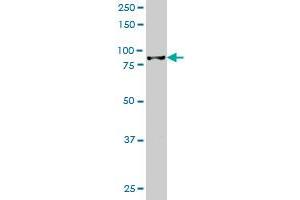 HIC1 monoclonal antibody (M02), clone 2F9 Western Blot analysis of HIC1 expression in Jurkat . (HIC1 Antikörper  (AA 396-453))