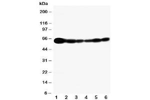 Western Blotting (WB) image for anti-SHC (Src Homology 2 Domain Containing) Transforming Protein 1 (SHC1) (C-Term) antibody (ABIN3032555)