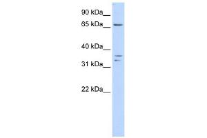 IQCE antibody used at 1 ug/ml to detect target protein. (IQCE Antikörper  (Middle Region))