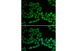 Immunofluorescence analysis of U2OS cells using TPMT antibody (ABIN5970397). (TPMT Antikörper)