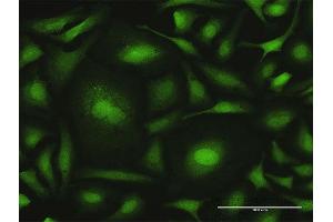 Immunofluorescence of purified MaxPab antibody to CALML6 on HeLa cell. (CALML6 Antikörper  (AA 1-181))