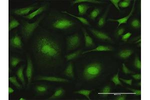 Immunofluorescence of purified MaxPab antibody to CALML6 on HeLa cell. (CALML6 Antikörper  (AA 1-181))