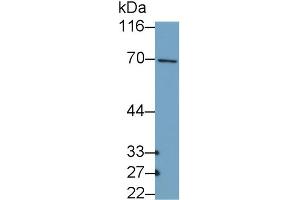 Detection of COL10 in MCF7 cell lysate using Polyclonal Antibody to Collagen Type X (COL10) (COL10 Antikörper  (AA 547-680))