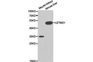 Western Blotting (WB) image for anti-LETM1 Domain Containing 1 (LETMD1) antibody (ABIN1873537)