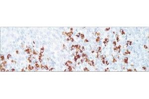 Image no. 1 for Rabbit anti-Human IgD (Chain delta) antibody (ABIN952831) (Kaninchen anti-Human IgD (Chain delta) Antikörper)