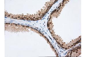 Immunohistochemical staining of paraffin-embedded Human Kidney tissue using anti-PDE4A mouse monoclonal antibody. (PDE4A Antikörper)