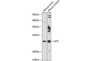 Western blot analysis of extracts of various cell lines, using NTS antibody (ABIN6128380, ABIN6144914, ABIN6144917 and ABIN6215934) at 1:3000 dilution. (Neurotensin Antikörper  (AA 24-148))