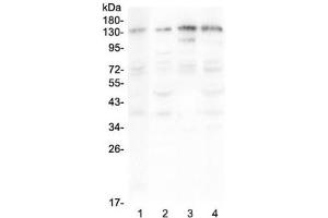 Western blot testing of human 1) A375, 2) HepG2, 3) Jurkat and 4) PANC-1 lysate with EPS15 antibody at 0. (EPS15 Antikörper)