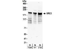 Western Blotting (WB) image for anti-Nuclear Receptor Coactivator 2 (NCOA2) (AA 700-750) antibody (ABIN7449570)