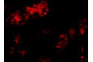 Immunofluorescence of BMF in human kidney tissue with BMF polyclonal antibody  at 10 ug/mL . (BMF Antikörper  (C-Term))
