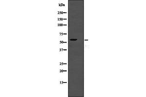 Western blot analysis of TSEN2 expression in TSEN2 transfected 293T lysate,The lane on the left is treated with the antigen-specific peptide. (TSEN2 Antikörper  (Internal Region))