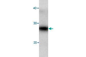 Western blot analysis of recombinant EIF5A protein with EIF5A polyclonal antibody  at 1:2000 dilution.