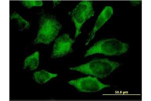 Immunofluorescence of monoclonal antibody to MAPK13 on HeLa cell. (MAPK13 Antikörper  (AA 251-365))