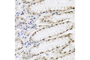 Immunohistochemistry of paraffin-embedded human stomach using SRSF9 antibody (ABIN5973601) (40x lens). (SFRS9 Antikörper)