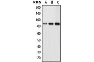 Western blot analysis of TLK1 expression in HeLa (A), NIH3T3 (B), PC12 (C) whole cell lysates. (TLK1 Antikörper  (Center))