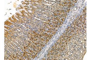 ABIN7095327 and ABIN7099384 at 1/100 staining rat stomach tissue by IHC-P. (PRELP Antikörper)