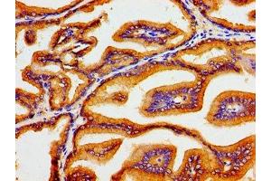 Immunohistochemistry of paraffin-embedded human prostate tissue using ABIN7170044 at dilution of 1:100