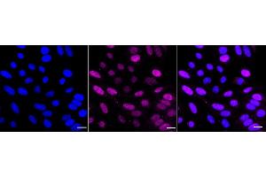 Immunocytochemical staining of HepG2 cells with RAD23A antibody (ABIN7800116), 1:1,000). (Rekombinanter RAD23A Antikörper)
